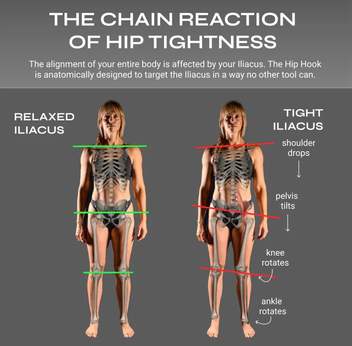 Hip Hook™ System | Aletha Health - Muscle release tool - Aletha Health